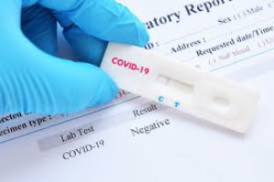 В області за останню добу виявили два нових випадки захворювання на COVID-19