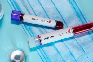 381: за останню добу в області виявили 5 нових випадків інфікування коронавірусом