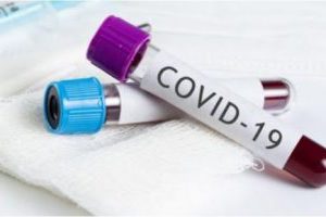 За останню добу в області виявили 11 нових випадків захворювання на коронавірусну інфекцію
