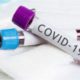 На Черкащині за добу +11 випадків інфікування коронавірусом