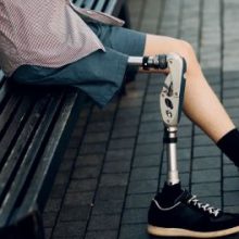 Безоплатне протезування: понад 56 тис. українців отримали 208 тис. засобів реабілітації