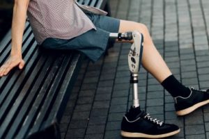 Безоплатне протезування: понад 56 тис. українців отримали 208 тис. засобів реабілітації